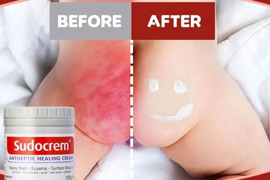 استفاده منظم از سودوکرم، منجر به ایجاد یک لایه محافظ روی پوست میشود.