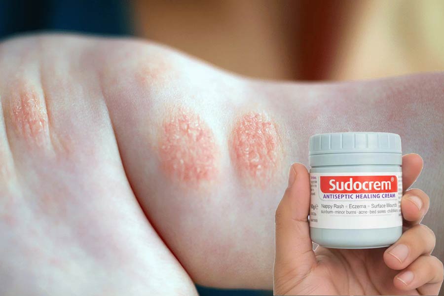 یک لایه سبک از سودوکرم به برطرف شدن اثر اگزما و نرمشدن پوست کمک میکند.